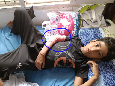 YS ਪਬਲਿਕ ਸਕੂਲ ਇੱਕ ਵਾਰ ਫੇਰ ਚਰਚਾ ‘ਚ…ਬਾਂਹ ‘ਤੇ ਸੱਟ ਲੱਗਣ ਕਾਰਨ ਬੱਚਾ ਸਿਵਲ ਹਸਪਤਾਲ ਦਾਖਲ…ਟੀਚਰ ‘ਤੇ ਲੱਗੇ ਦੋਸ਼