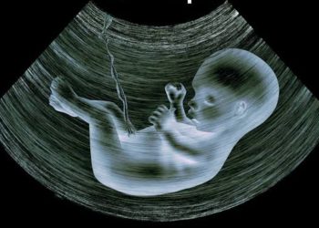 ਗ਼ਲਤ ਸਕੈਨ ਰਿਪੋਰਟ ਦੇਣ ਵਾਲੇ ਸਕੈਨ ਸੈਂਟਰ ਨੂੰ ਅਦਾਲਤ ਨੇ ਲਗਾਇਆ 16.50 ਲੱਖ ਦਾ ਜੁਰਮਾਨਾ