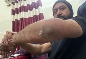 ਵੱਡੀ ਖ਼ਬਰ…ਹਾਈ ਕੋਰਟ ਨੇ ਕਰਨਲ ਬਾਠ ਕੁੱਟਮਾਰ ਮਾਮਲੇ ਦੀ ਜਾਂਚ ਸੀਬੀਆਈ ਨੂੰ ਸੌਂਪੀ